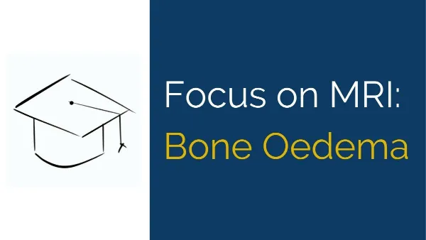 mri bone oedema